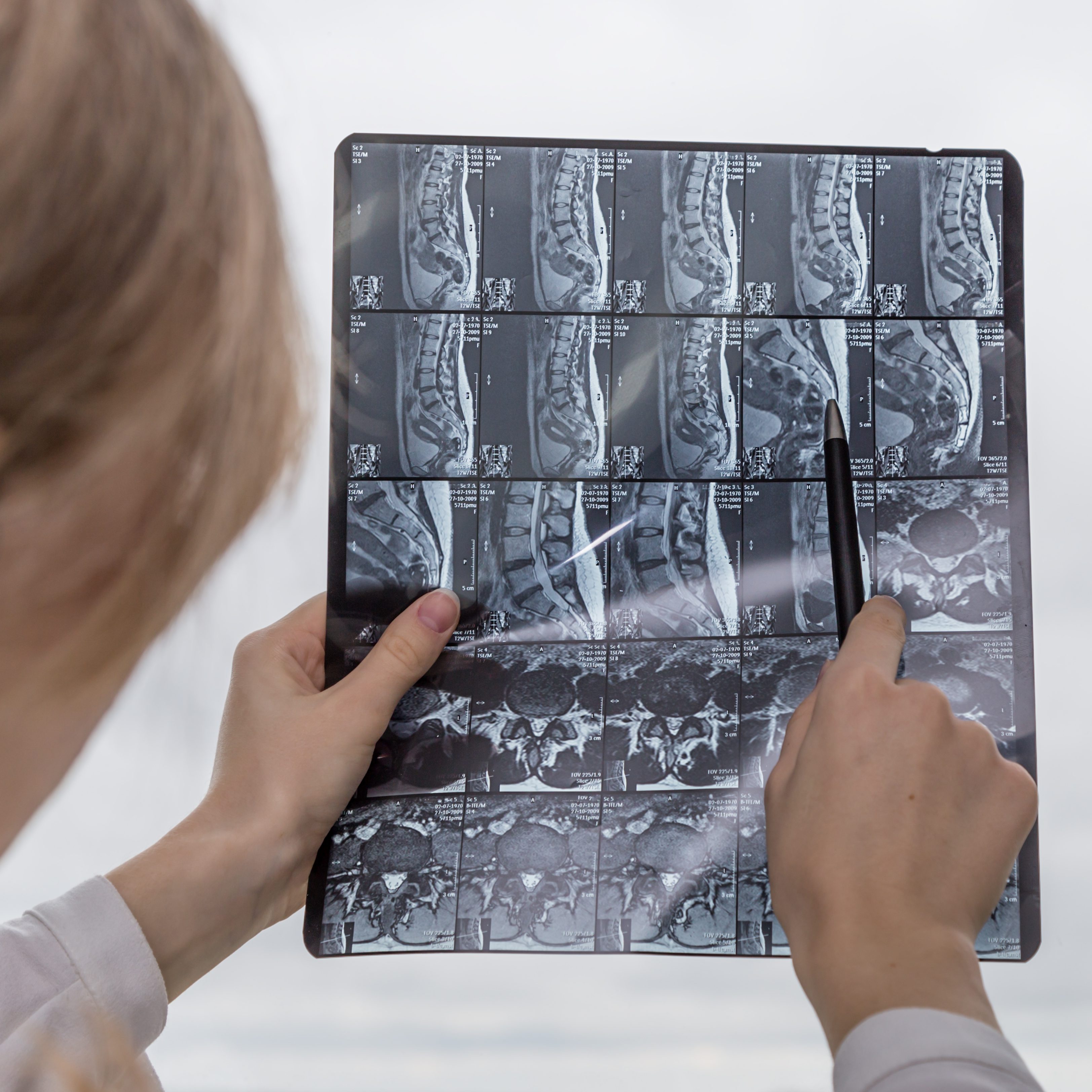 Sténose spinale Clinique TAGMED